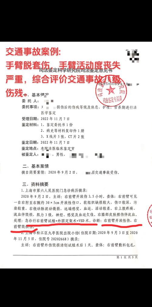 假如有人扇了你一巴掌，可以索赔多少钱？
